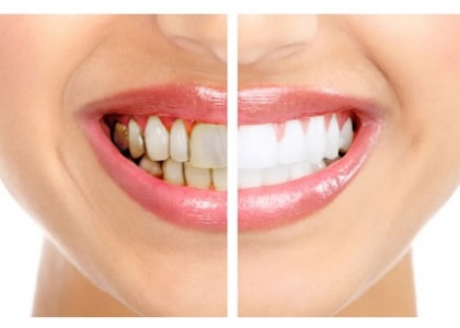 gallery/servicios_rehabilitacion-oral